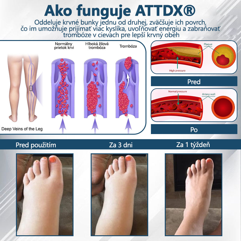 💧💧ATTDX® Bylinný krém na úľavu od opuchov s čiernou rascou