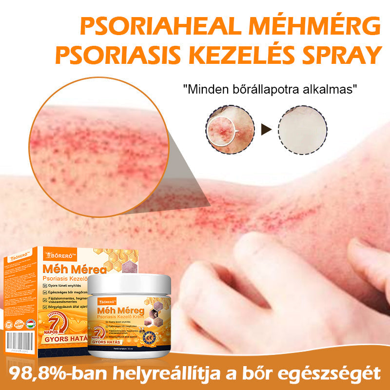 đăHivatalos MĂĄrkaboltăBĆRERĆâą MĂ©h MĂ©reg Psoriasis KezelĆ KrĂ©mïŒâPikkelysömörâSzemölcsâKörömgombaâïŒïŒ