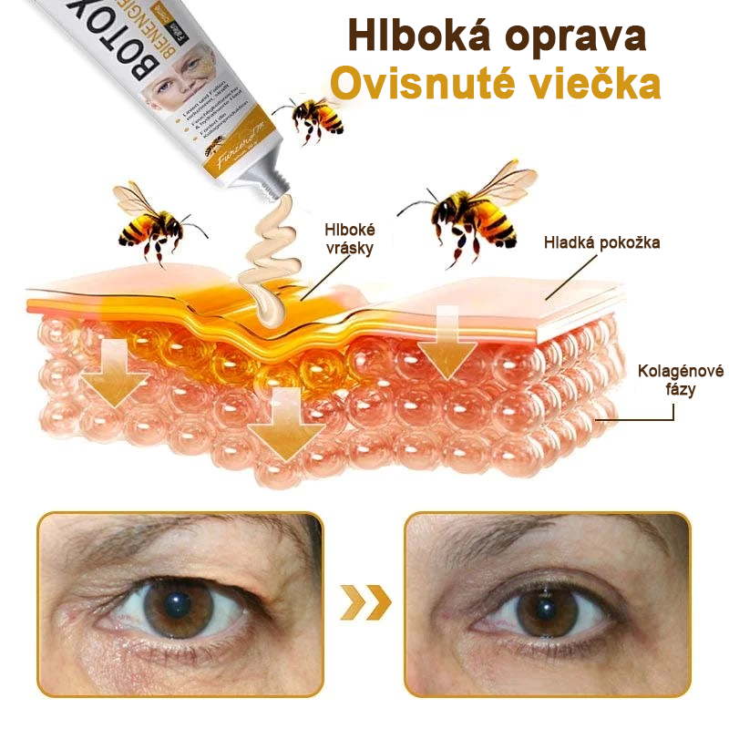 🍀👩⚕️Získajte mladistvú pleť hneď teraz! - 👩⚕️Furzero™ Botoxový krém na odstraňovanie vrások s obsahom včelieho jedu - (posledný deň 70% zľava)