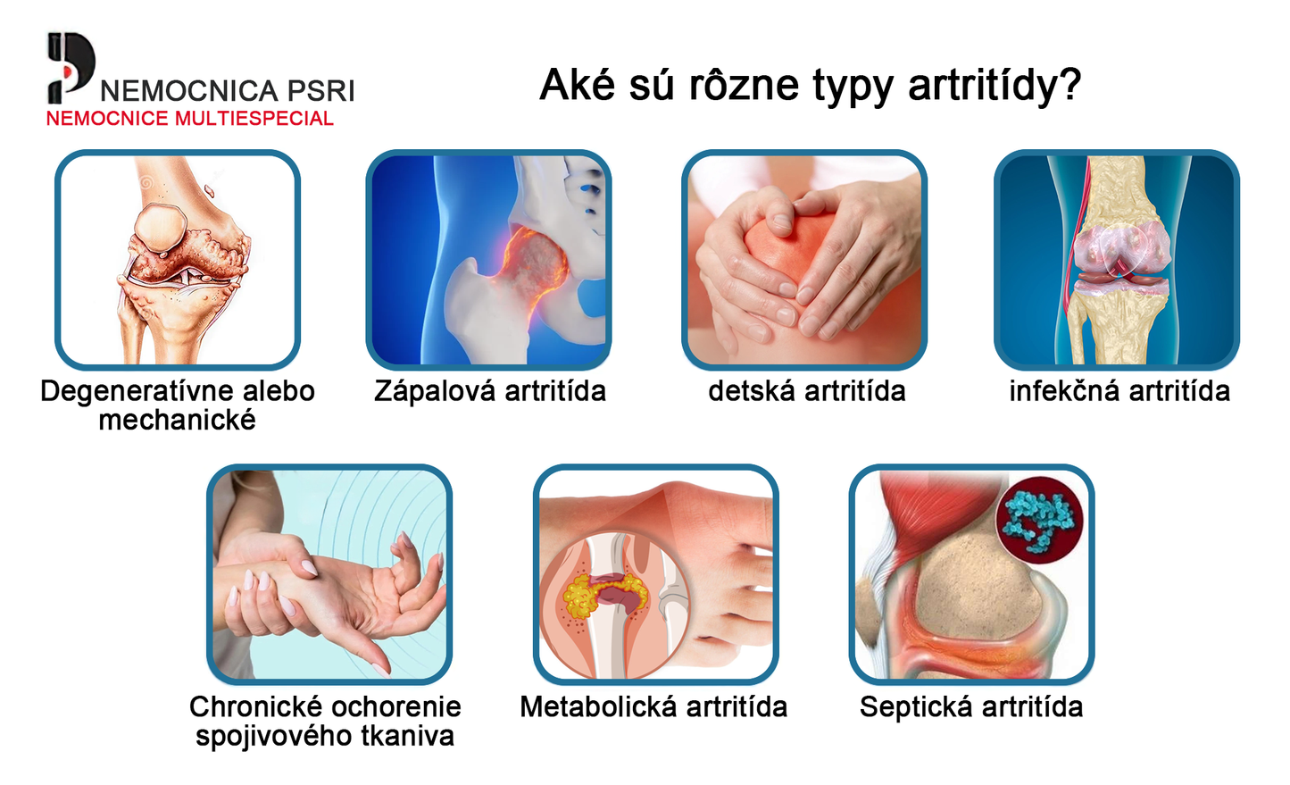LOVILDS™ Včelí jed a kurkumový terapeutický krém na artritídu (👩🔬Špecializovaný na ortopedické ochorenia a bolesti kĺbov👩🔬)
