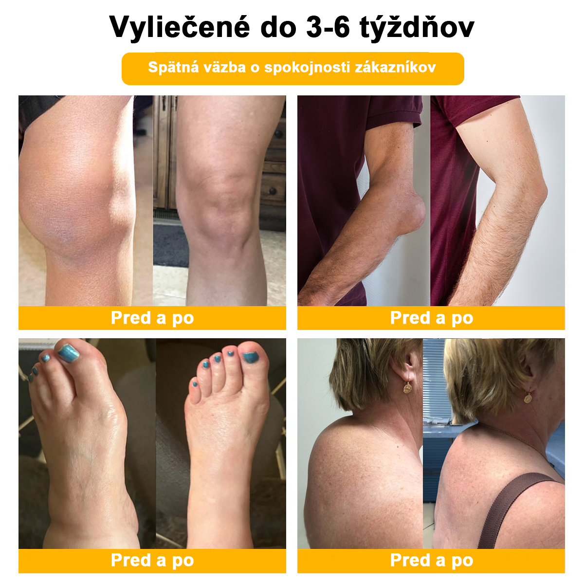 LOVILDS™ Včelí jed a kurkumový terapeutický krém na artritídu (👩🔬Špecializovaný na ortopedické ochorenia a bolesti kĺbov👩🔬)