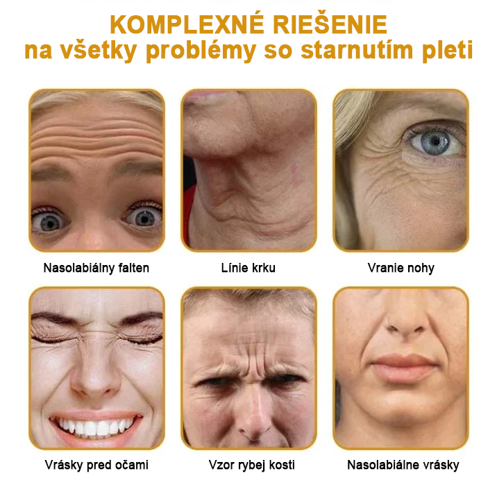 🍀👩⚕️Získajte mladistvú pleť hneď teraz! - 👩⚕️Furzero™ Botoxový krém na odstraňovanie vrások s obsahom včelieho jedu - (posledný deň 70% zľava)