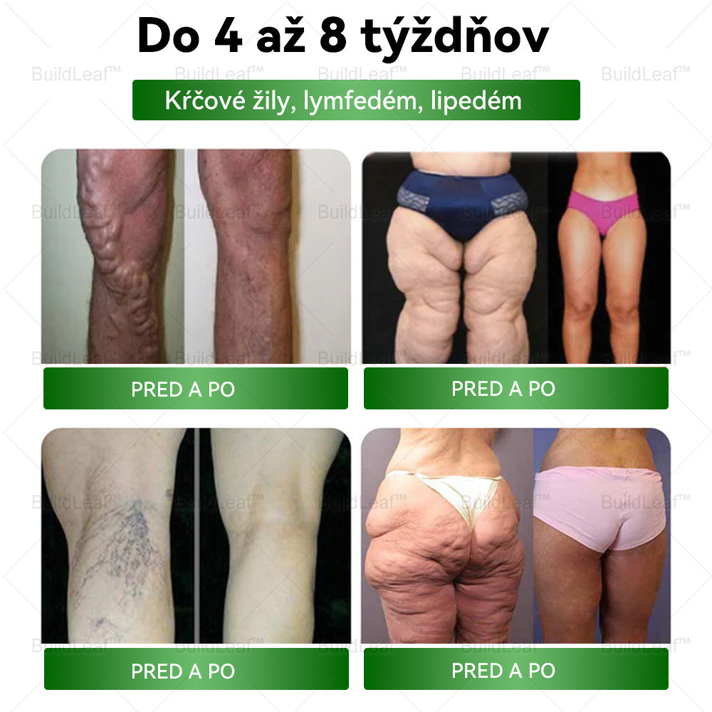 👩⚕Odporúčané klinikou Mayo | Oficiálny obchod | BuildLeaf® GLP-1 Moringa Slimming & Health Boost Drops🔥 Obezita, kardiovaskulárne ochorenia, cukrovka, spánkové apnoe, problémy s kĺbmi a ďalšie