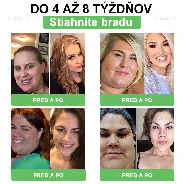 💖BuildLeaf® GLP-1 6-v-1 Health Solution Perorálna tekutina (Len raz denne, viditeľné zmeny už za 7 dní) Pre obezitu, kardiovaskulárne ochorenia, cukrovku, spánkové apnoe, zdravie čriev, problémy s kĺbmi a ďalšie
