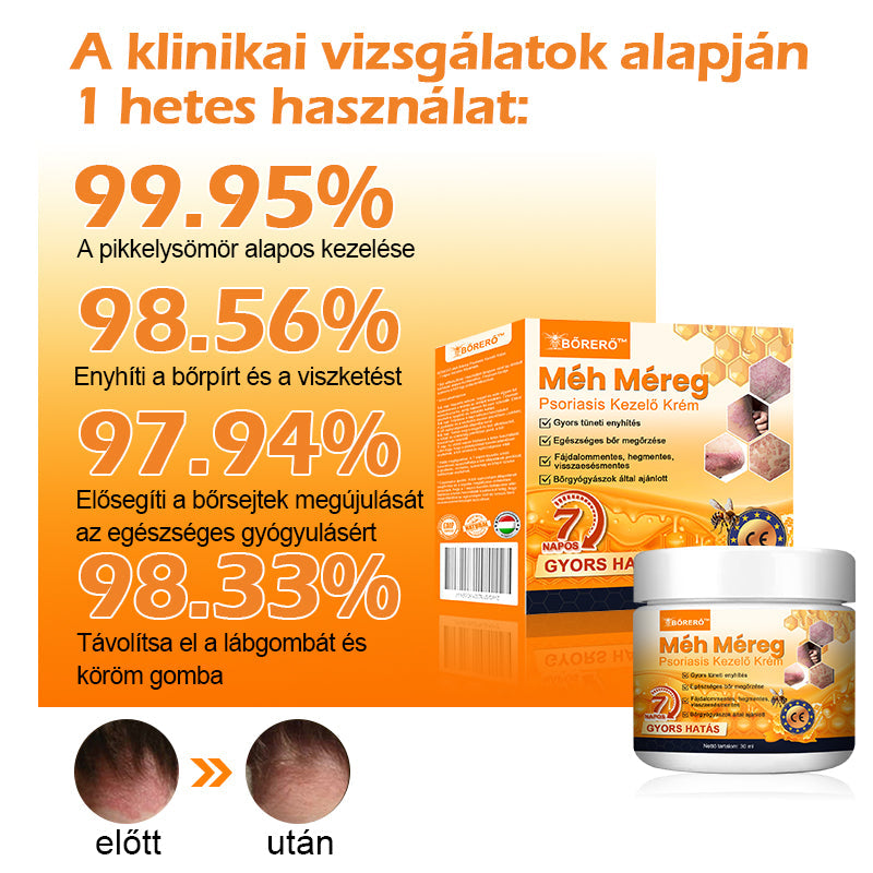 đăHivatalos MĂĄrkaboltăBĆRERĆâą MĂ©h MĂ©reg Psoriasis KezelĆ KrĂ©mïŒâPikkelysömörâSzemölcsâKörömgombaâïŒïŒ