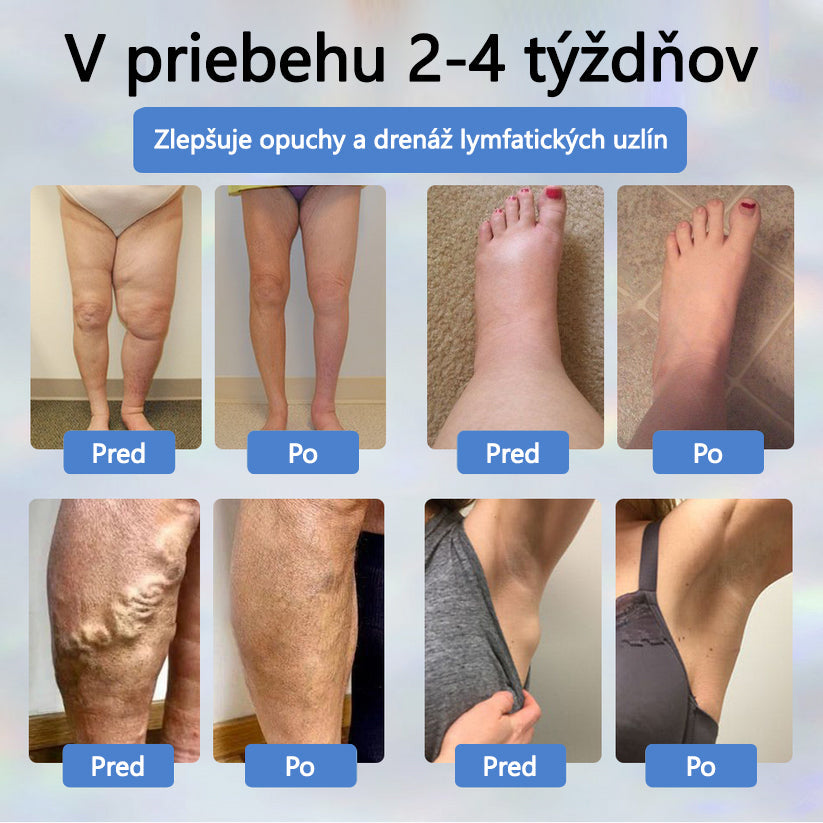 💧💧ATTDX® Bylinný krém na úľavu od opuchov s čiernou rascou
