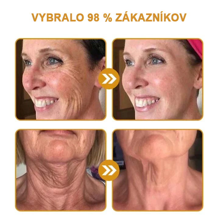 🍀👩⚕️Získajte mladistvú pleť hneď teraz! - 👩⚕️Furzero™ Botoxový krém na odstraňovanie vrások s obsahom včelieho jedu - (posledný deň 70% zľava)