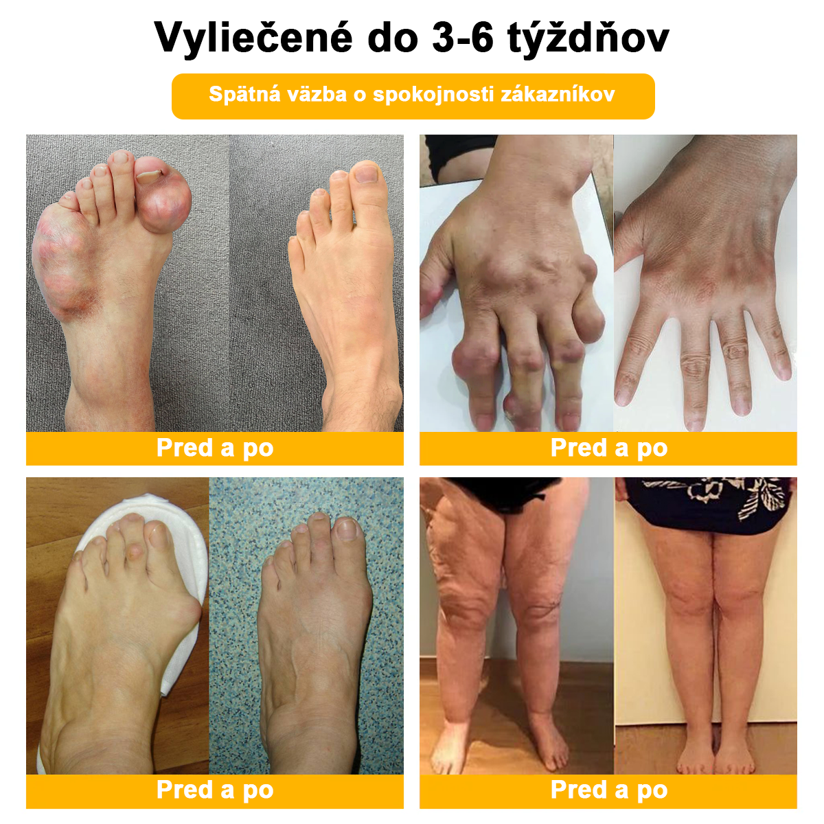 LOVILDS™ Včelí jed a kurkumový terapeutický krém na artritídu (👩🔬Špecializovaný na ortopedické ochorenia a bolesti kĺbov👩🔬)