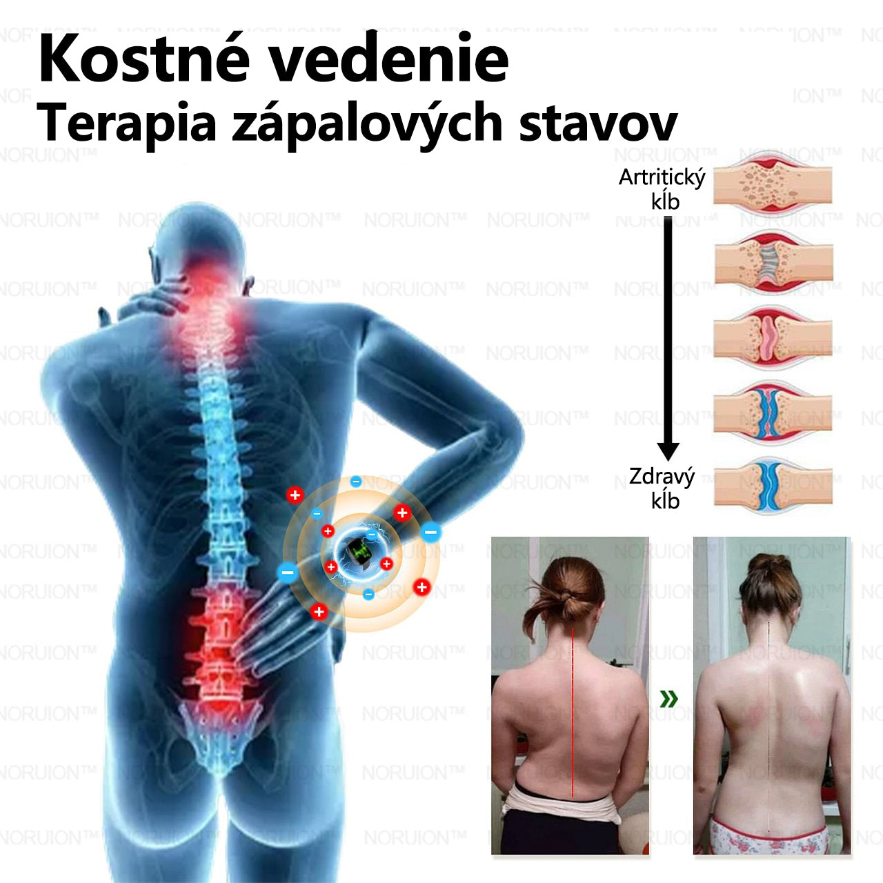🎁 Zostáva iba 5 boxov! Ponúkame extra 50% zľavu! Zostaňte zdraví. Schudnite teraz, novoročná zľava.