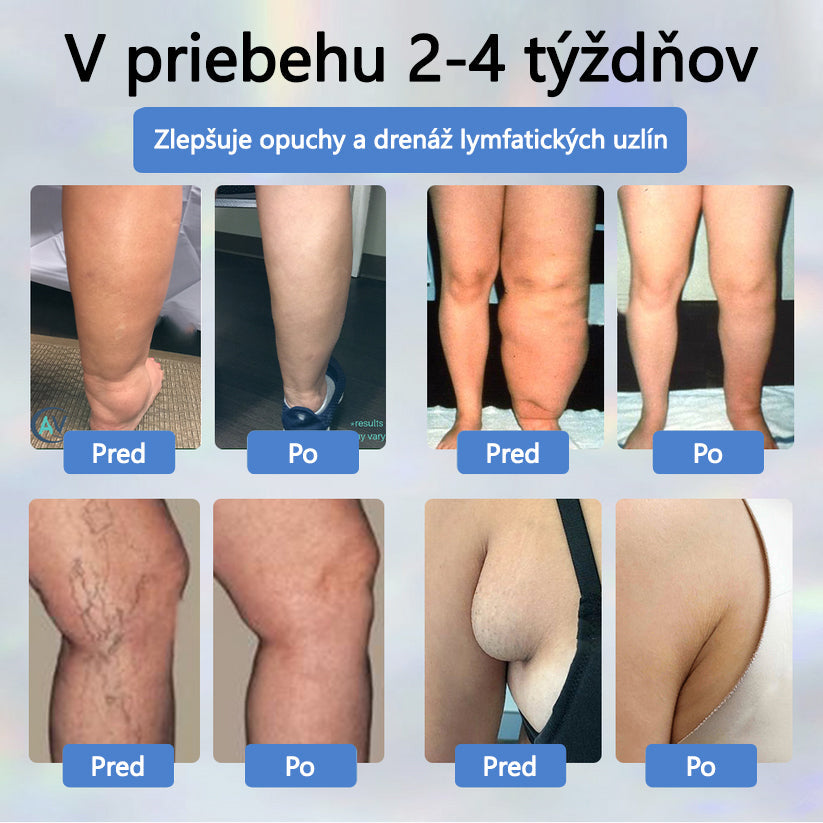 💧💧ATTDX® Bylinný krém na úľavu od opuchov s čiernou rascou