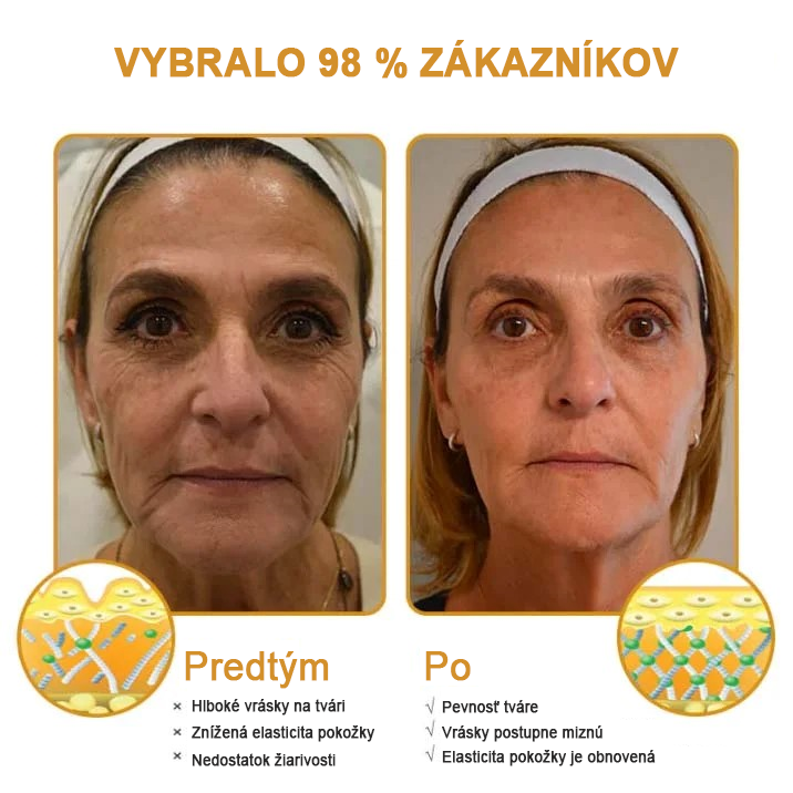 🍀👩⚕️Získajte mladistvú pleť hneď teraz! - 👩⚕️Furzero™ Botoxový krém na odstraňovanie vrások s obsahom včelieho jedu - (posledný deň 70% zľava)