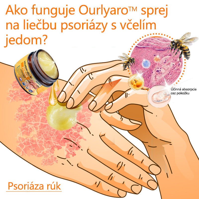🌿Pokročilá masť na liečbu psoriázy Ourlyard™ (👨⚕Odporúčané lekárom) je certifikovaná Slovenským ústavom liečiv a zdravotníckych pomôcok (BFARM) a získala certifikáciu CE.