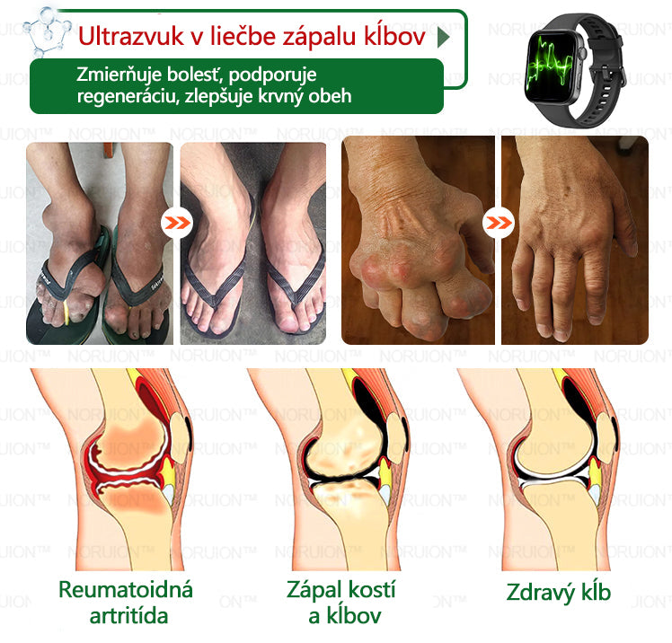 🎁 Zostáva iba 5 boxov! Ponúkame extra 50% zľavu! Zostaňte zdraví. Schudnite teraz, novoročná zľava.