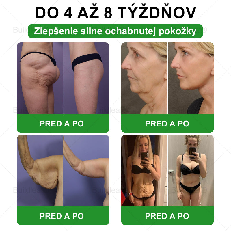 💖BuildLeaf® GLP-1 6-v-1 Health Solution Perorálna tekutina (Len raz denne, viditeľné zmeny už za 7 dní) Pre obezitu, kardiovaskulárne ochorenia, cukrovku, spánkové apnoe, zdravie čriev, problémy s kĺbmi a ďalšie
