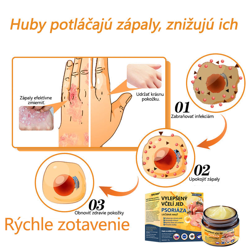 🌿Pokročilá masť na liečbu psoriázy Ourlyard™ (👨⚕Odporúčané lekárom) je certifikovaná Slovenským ústavom liečiv a zdravotníckych pomôcok (BFARM) a získala certifikáciu CE.
