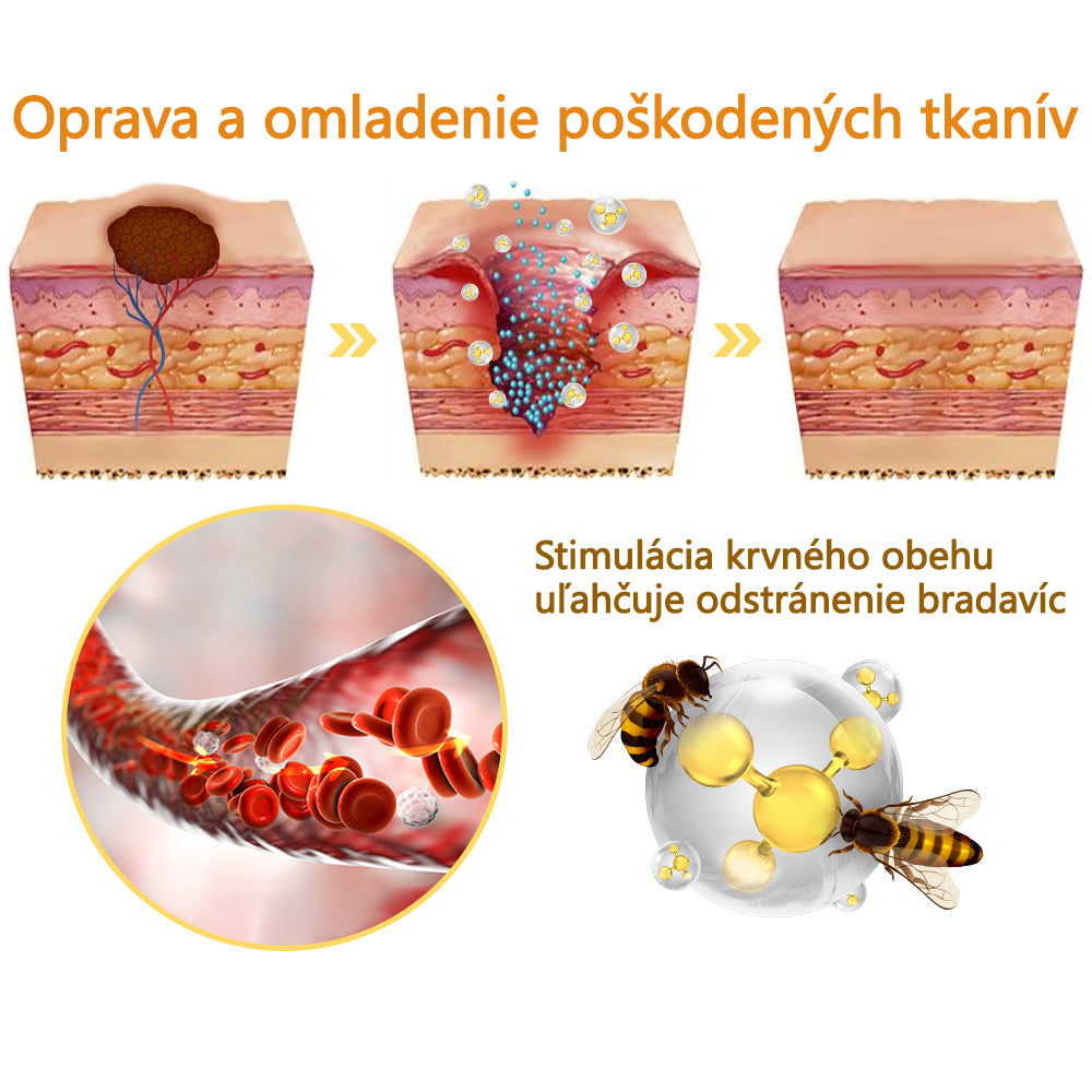 flysmus™ Ošetrenie Sprej na Včelím Jedom Na odstránenie kožných štítkov a bradavíc
