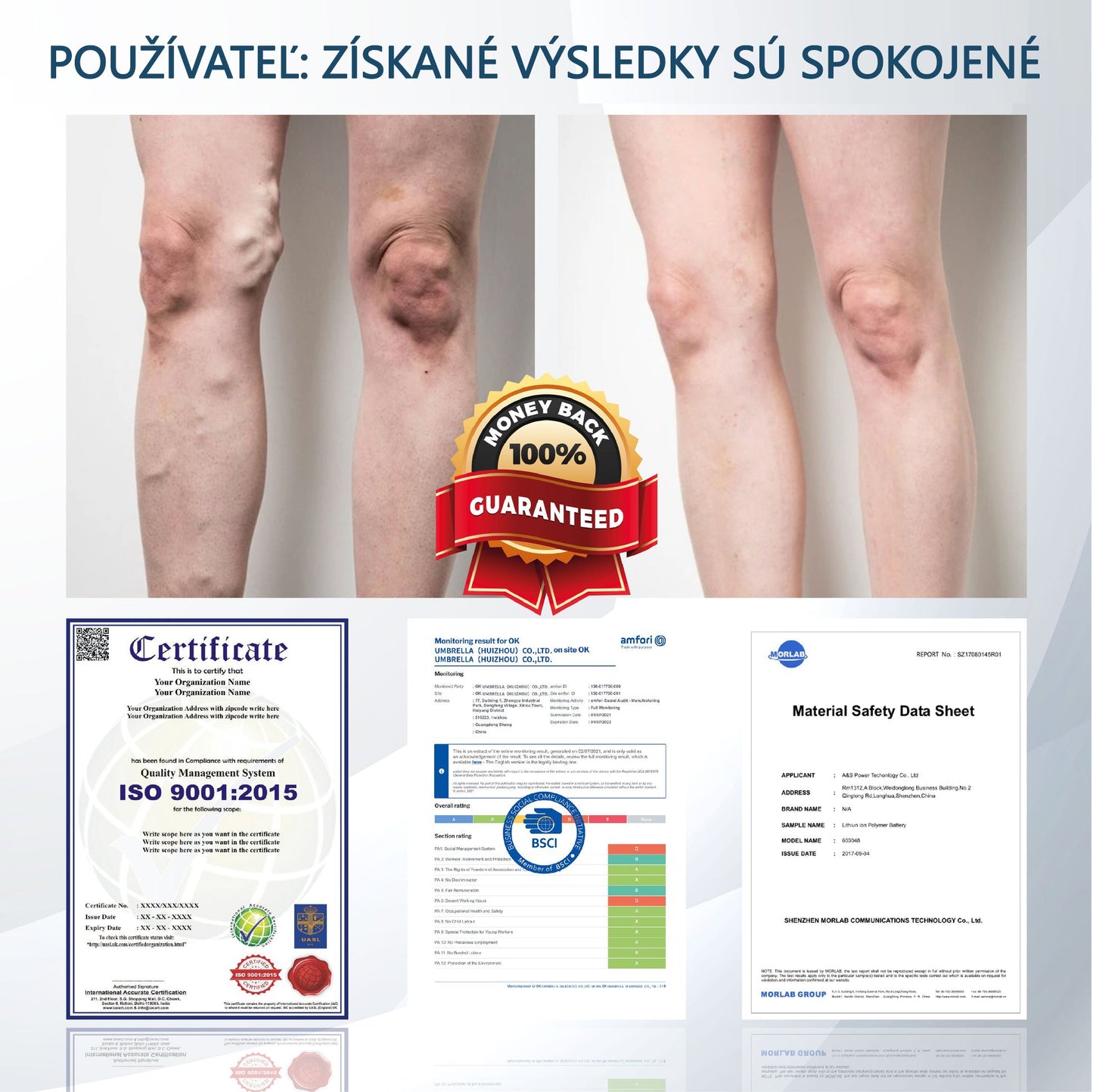 💧💧ATTDX® Bylinný krém na úľavu od opuchov s čiernou rascou