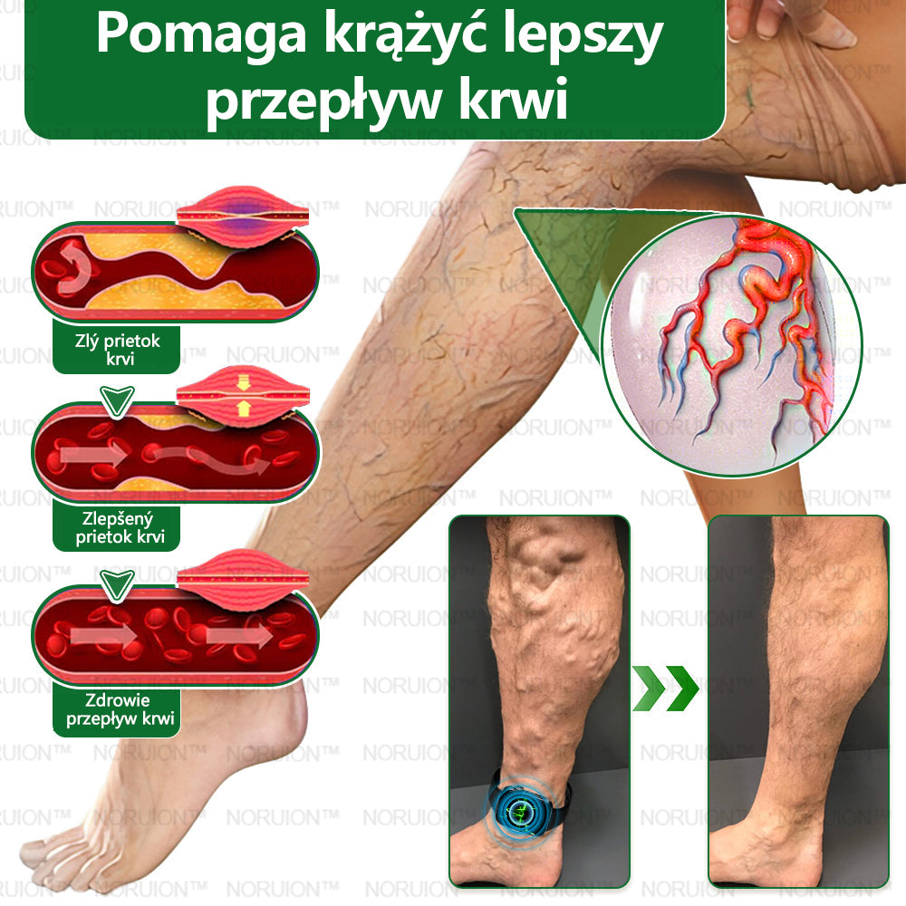 🎁 Zostáva iba 5 boxov! Ponúkame extra 50% zľavu! Zostaňte zdraví. Schudnite teraz, novoročná zľava.