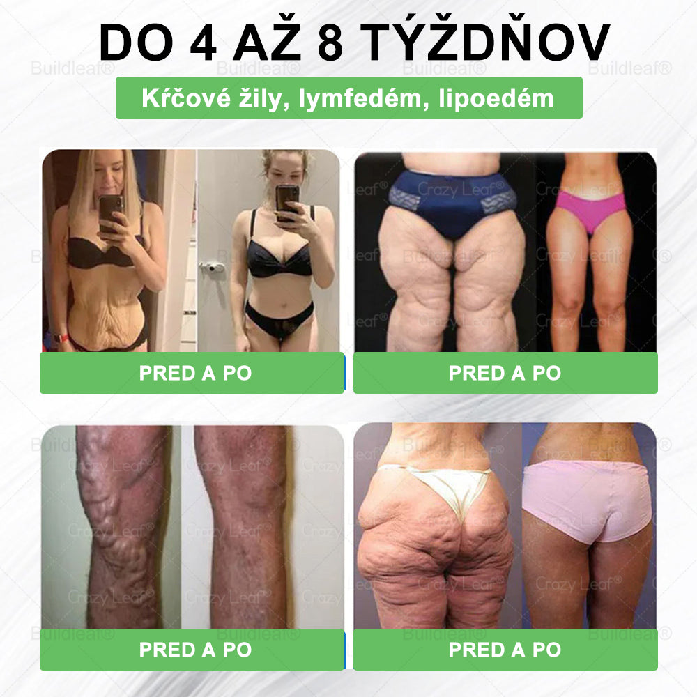 💖BuildLeaf® GLP-1 6-v-1 Health Solution Perorálna tekutina (Len raz denne, viditeľné zmeny už za 7 dní) Pre obezitu, kardiovaskulárne ochorenia, cukrovku, spánkové apnoe, zdravie čriev, problémy s kĺbmi a ďalšie