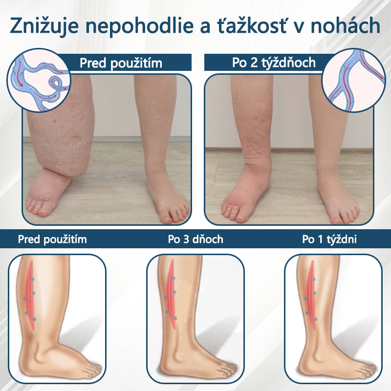 💧💧ATTDX® Bylinný krém na úľavu od opuchov s čiernou rascou