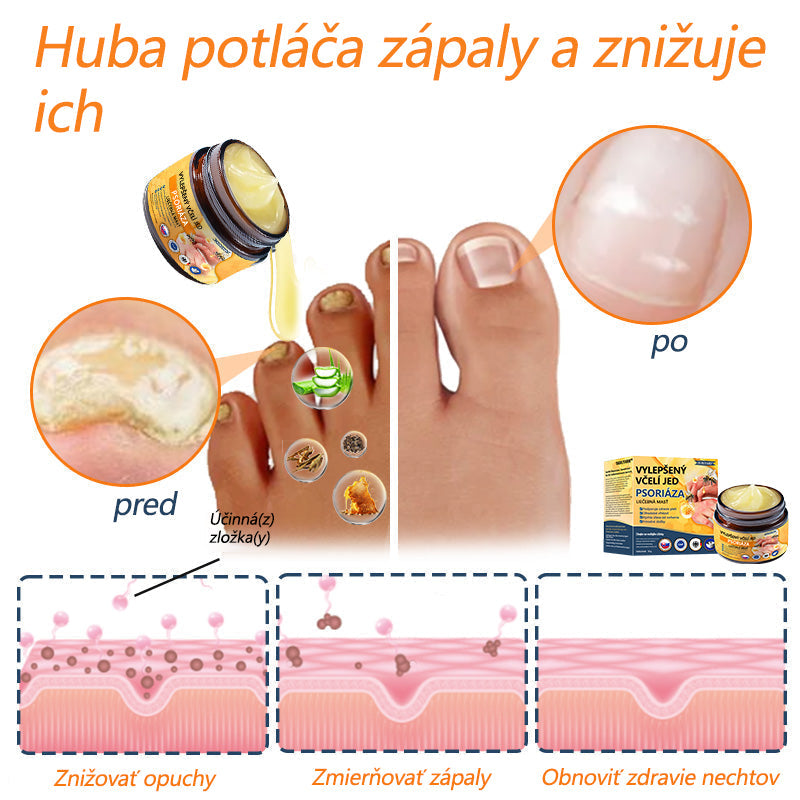 🌿Pokročilá masť na liečbu psoriázy Ourlyard™ (👨⚕Odporúčané lekárom) je certifikovaná Slovenským ústavom liečiv a zdravotníckych pomôcok (BFARM) a získala certifikáciu CE.