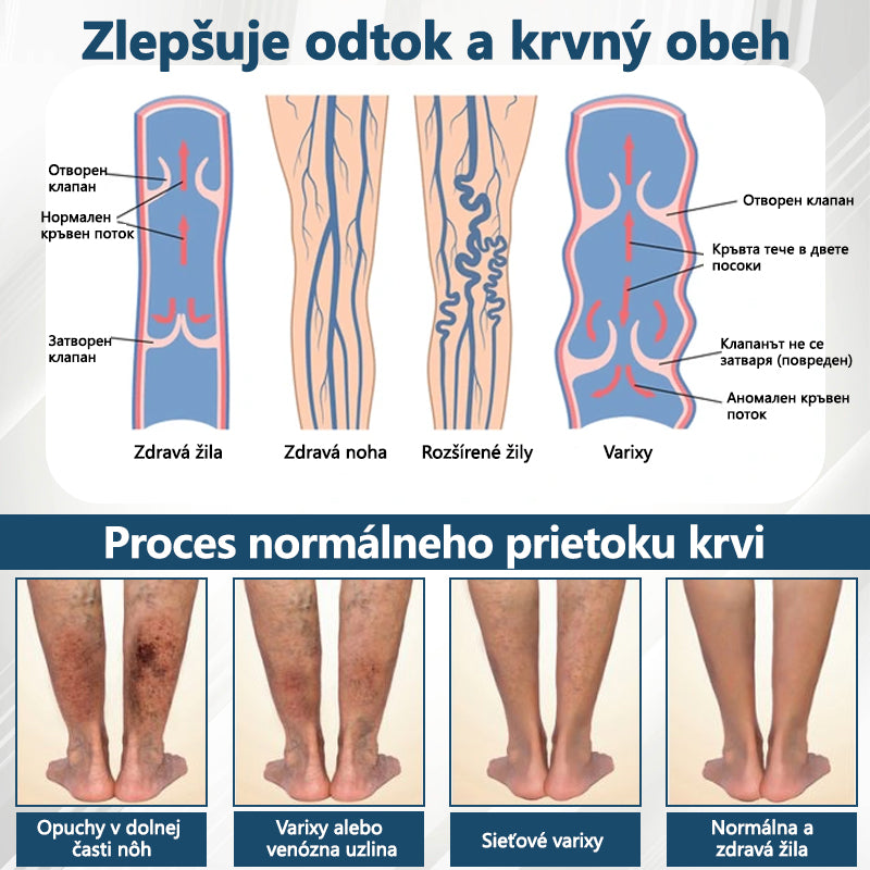 💧💧ATTDX® Bylinný krém na úľavu od opuchov s čiernou rascou