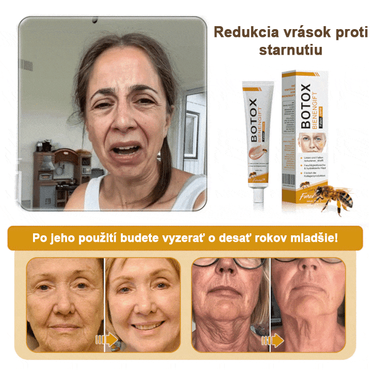 🍀👩⚕️Získajte mladistvú pleť hneď teraz! - 👩⚕️Furzero™ Botoxový krém na odstraňovanie vrások s obsahom včelieho jedu - (posledný deň 70% zľava)