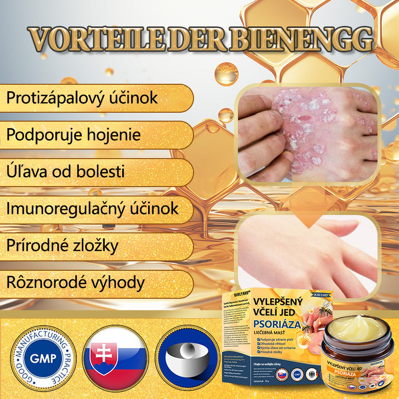🌿Pokročilá masť na liečbu psoriázy Ourlyard™ (👨⚕Odporúčané lekárom) je certifikovaná Slovenským ústavom liečiv a zdravotníckych pomôcok (BFARM) a získala certifikáciu CE.