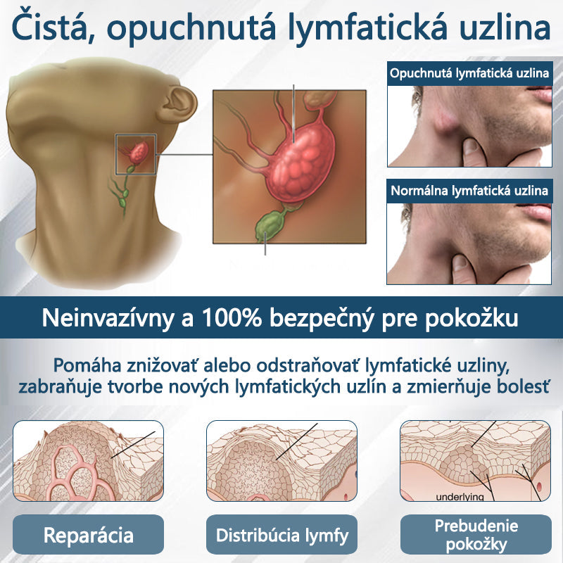 💧💧ATTDX® Bylinný krém na úľavu od opuchov s čiernou rascou