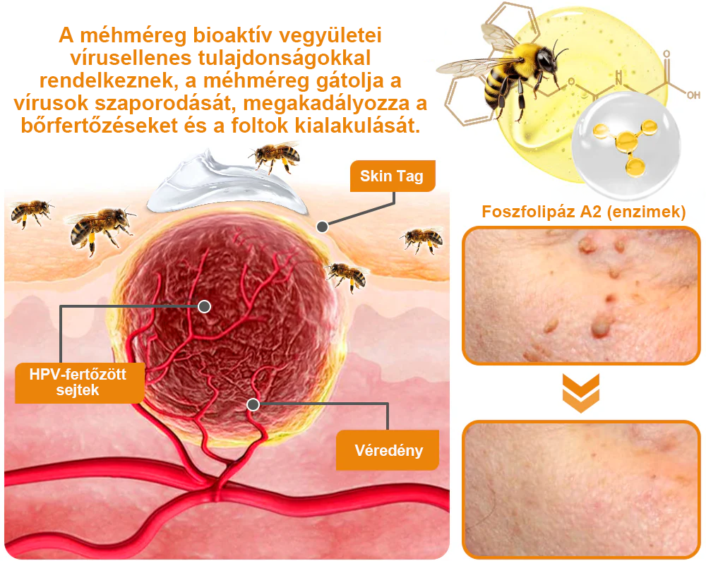 đăHivatalos MĂĄrkaboltăBĆRERĆâą MĂ©h MĂ©reg Psoriasis KezelĆ KrĂ©mïŒâPikkelysömörâSzemölcsâKörömgombaâïŒïŒ