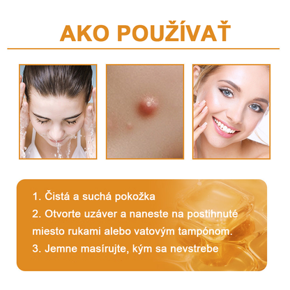 🏵️[Oficiálny vlajkový obchod] 𝑻𝒖𝒓𝒐𝒏𝒖™ Krém na ošetrenie pleti s včelím jedom (👨‍⚕𝐀𝐀𝐃 ODPORÚČANIA)