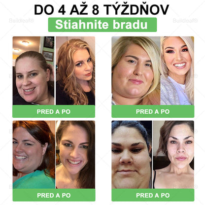 💖BuildLeaf® GLP-1 6-v-1 Health Solution Perorálna tekutina (Len raz denne, viditeľné zmeny už za 7 dní) Pre obezitu, kardiovaskulárne ochorenia, cukrovku, spánkové apnoe, zdravie čriev, problémy s kĺbmi a ďalšie