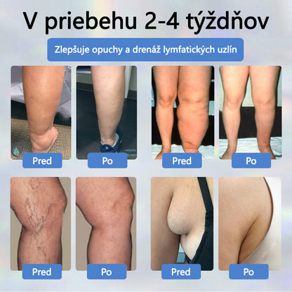💧💧ATTDX® Bylinný krém na úľavu od opuchov s čiernou rascou