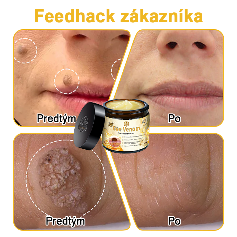 🏵️[Oficiálny vlajkový obchod] 𝑻𝒖𝒓𝒐𝒏𝒖™ Krém na ošetrenie pleti s včelím jedom (👨‍⚕𝐀𝐀𝐃 ODPORÚČANIA)