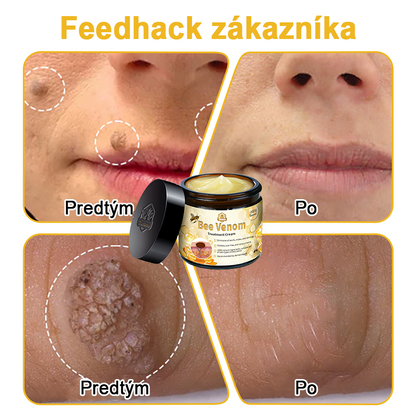 🏵️[Oficiálny vlajkový obchod] 𝑻𝒖𝒓𝒐𝒏𝒖™ Krém na ošetrenie pleti s včelím jedom (👨‍⚕𝐀𝐀𝐃 ODPORÚČANIA)