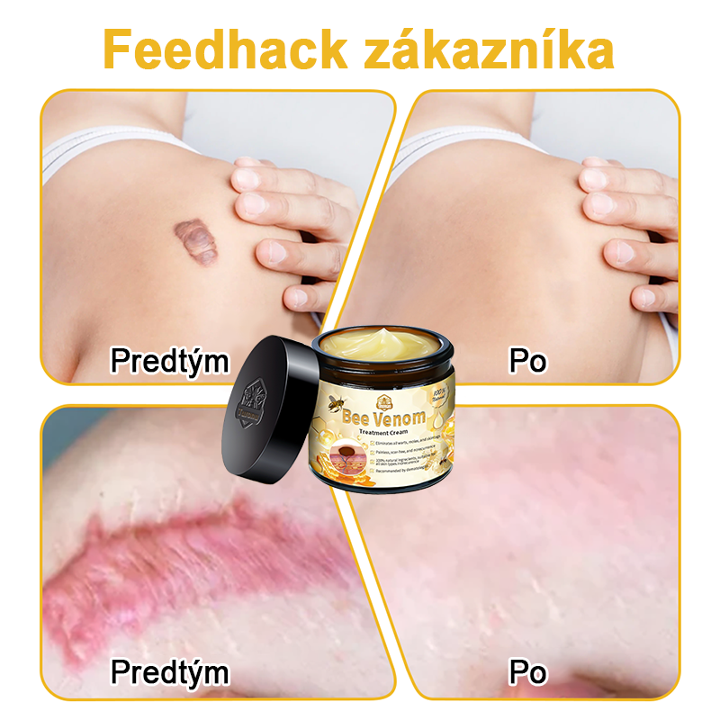 🏵️[Oficiálny vlajkový obchod] 𝑻𝒖𝒓𝒐𝒏𝒖™ Krém na ošetrenie pleti s včelím jedom (👨‍⚕𝐀𝐀𝐃 ODPORÚČANIA)