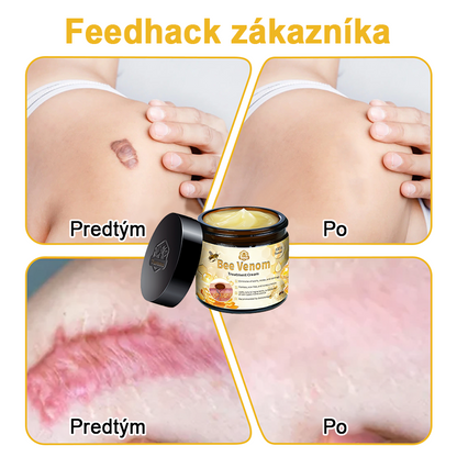 🏵️[Oficiálny vlajkový obchod] 𝑻𝒖𝒓𝒐𝒏𝒖™ Krém na ošetrenie pleti s včelím jedom (👨‍⚕𝐀𝐀𝐃 ODPORÚČANIA)