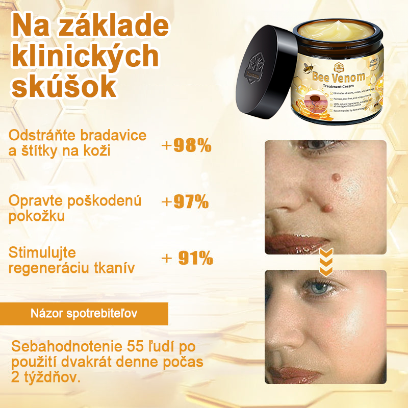 🏵️[Oficiálny vlajkový obchod] 𝑻𝒖𝒓𝒐𝒏𝒖™ Krém na ošetrenie pleti s včelím jedom (👨‍⚕𝐀𝐀𝐃 ODPORÚČANIA)