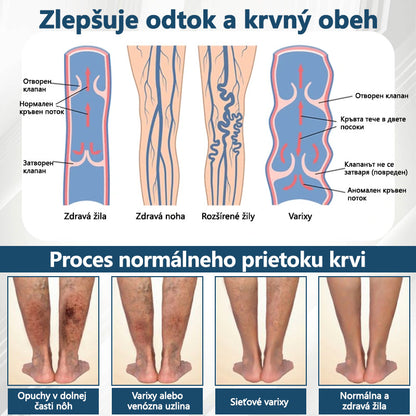 💧💧ATTDX® Bylinný krém na úľavu od opuchov s čiernou rascou