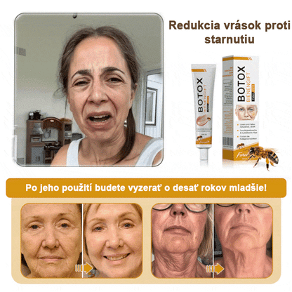 🍀👩‍⚕️Získajte mladistvú pleť hneď teraz! - 👩‍⚕️Furzero™ Botoxový krém na odstraňovanie vrások s obsahom včelieho jedu - (posledný deň 70% zľava)